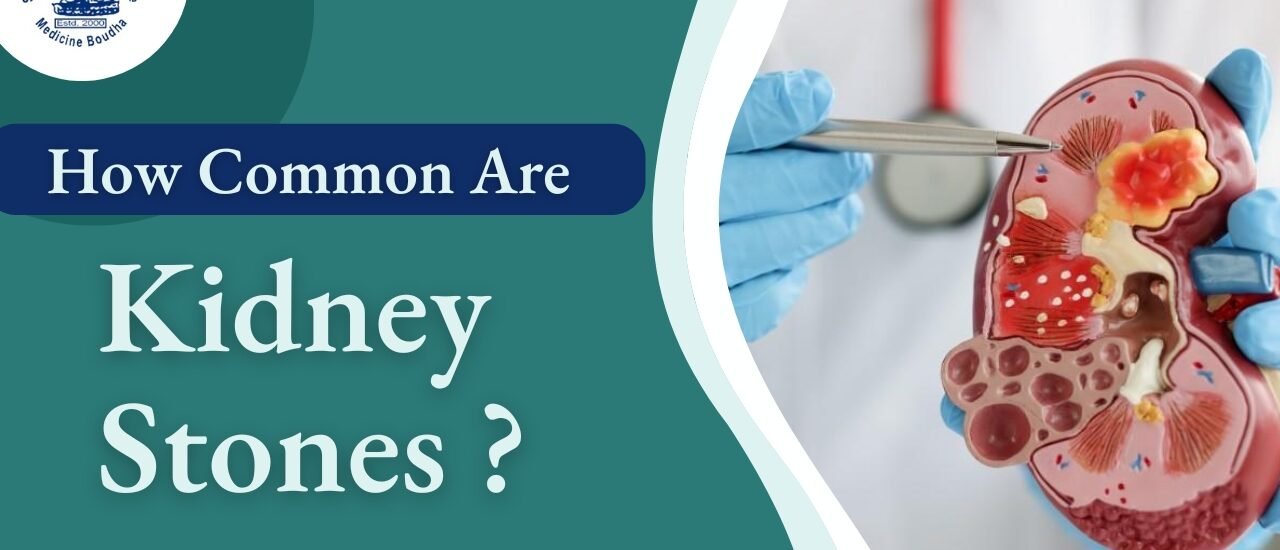 How common are kidney stones?