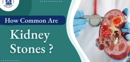 How common are kidney stones?