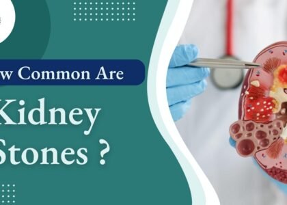 How common are kidney stones?