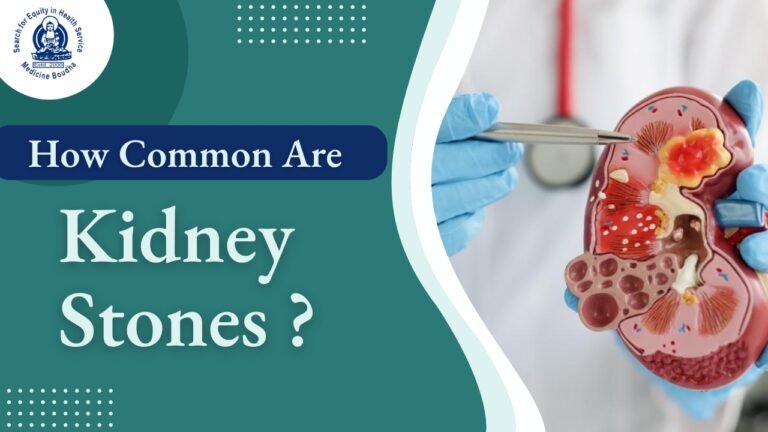 How Common Are Kidney Stones?